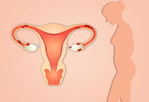 如何通过武汉孕成国际试管婴儿来预防卵巢早衰?